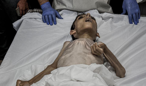Ali Al Attar, bocah belasan tahun ditemukan msih bernyawa setelah terkubur reruntuhan gedung berminghu minggu yang hancur akibat pemboman oleh zionis